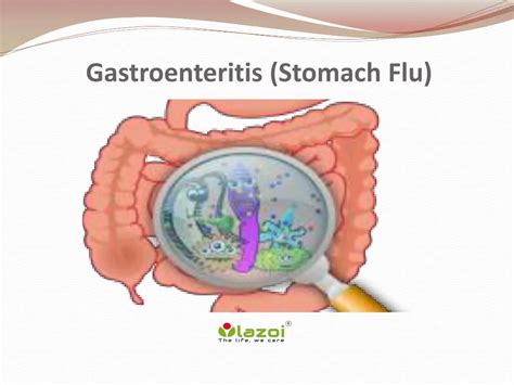 gamot sa gastroenteritis|Gastroenteritis (Stomach Flu): Symptoms, Causes, Treatments.